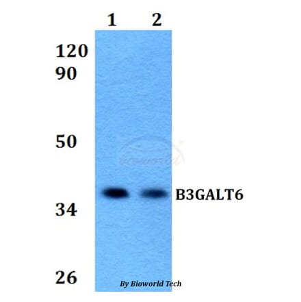 Anti-B3GALT6 Antibody from Bioworld Technology (BS60590) - Antibodies.com