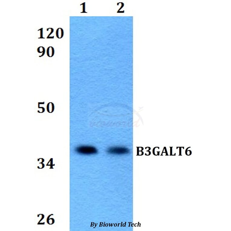 Anti-B3GALT6 Antibody from Bioworld Technology (BS60590) - Antibodies.com