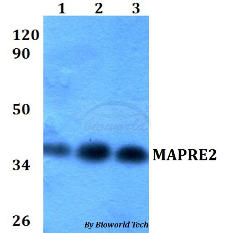 Anti-MAPRE2 Antibody from Bioworld Technology (BS60593) - Antibodies.com