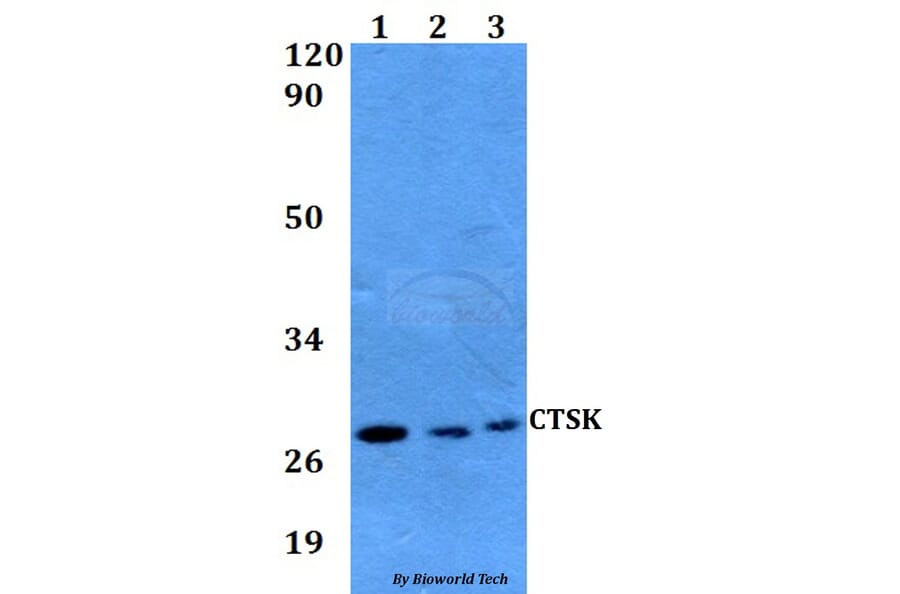 Anti-CTSK Antibody from Bioworld Technology (BS60594) - Antibodies.com