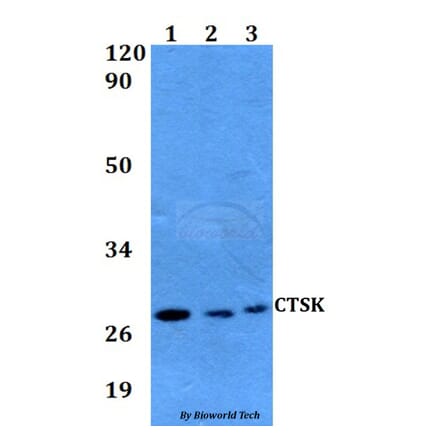 Anti-CTSK Antibody from Bioworld Technology (BS60594) - Antibodies.com