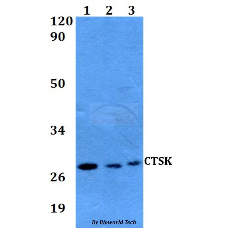 Anti-CTSK Antibody from Bioworld Technology (BS60594) - Antibodies.com