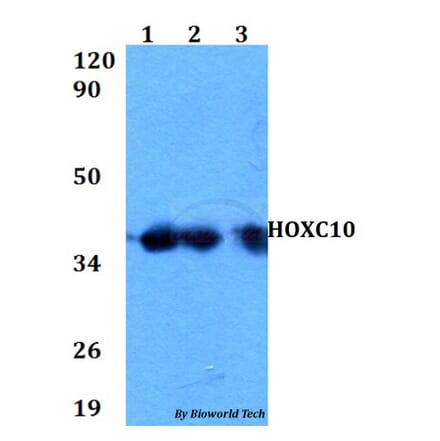 Anti-HOXC10 Antibody from Bioworld Technology (BS60596) - Antibodies.com