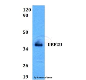 Anti-UBE2U Antibody from Bioworld Technology (BS60597) - Antibodies.com
