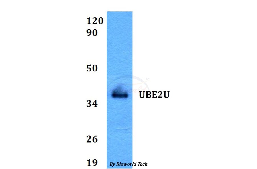 Anti-UBE2U Antibody from Bioworld Technology (BS60597) - Antibodies.com