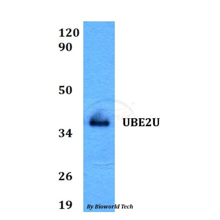 Anti-UBE2U Antibody from Bioworld Technology (BS60597) - Antibodies.com