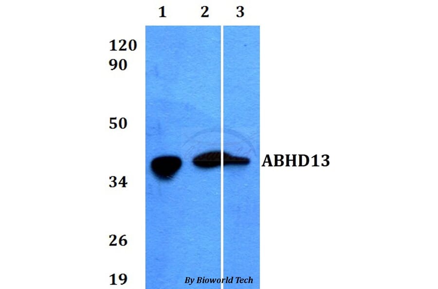Anti-ABHD13 Antibody from Bioworld Technology (BS60600) - Antibodies.com