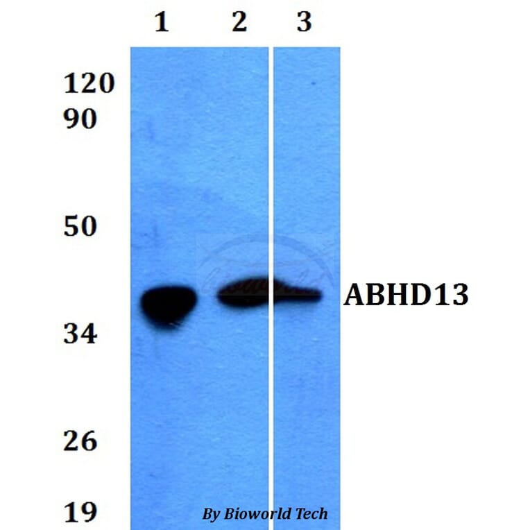 Anti-ABHD13 Antibody from Bioworld Technology (BS60600) - Antibodies.com