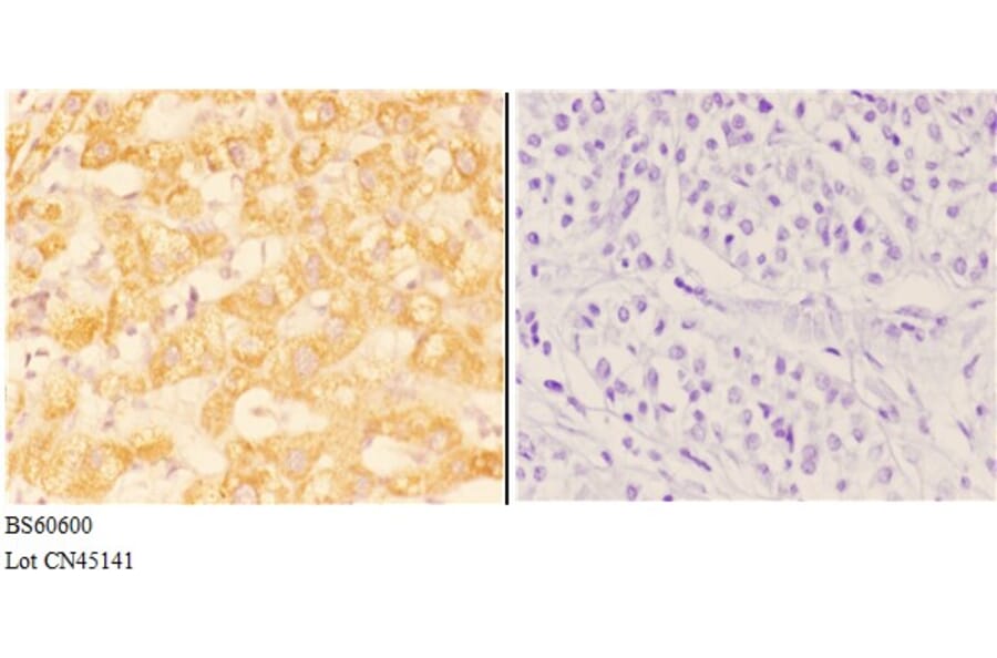 Anti-ABHD13 Antibody from Bioworld Technology (BS60600) - Antibodies.com