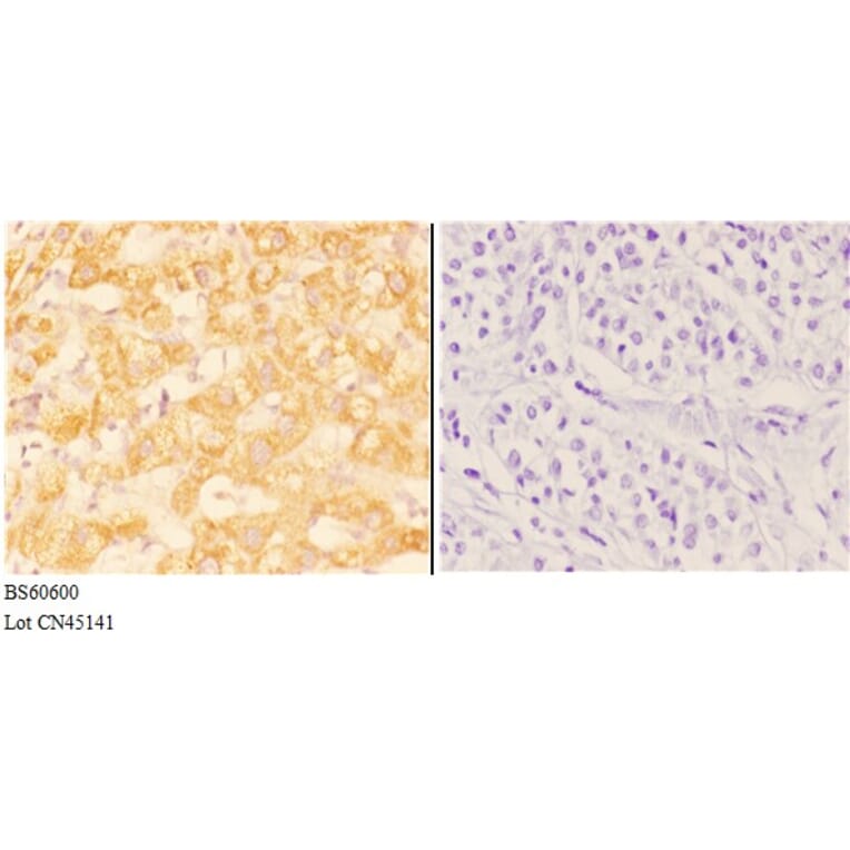 Anti-ABHD13 Antibody from Bioworld Technology (BS60600) - Antibodies.com