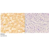 Anti-ABHD13 Antibody from Bioworld Technology (BS60600) - Antibodies.com