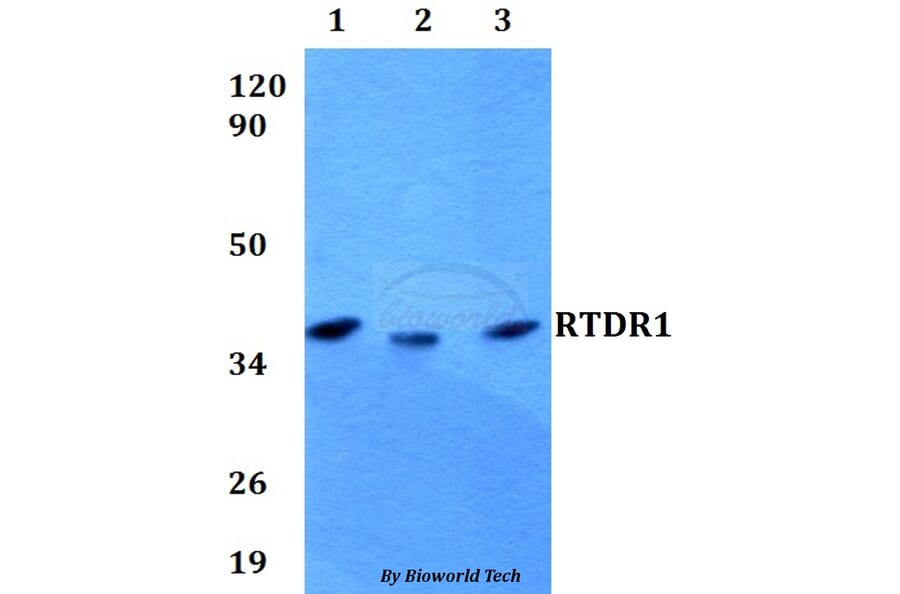 Anti-RTDR1 Antibody from Bioworld Technology (BS60603) - Antibodies.com