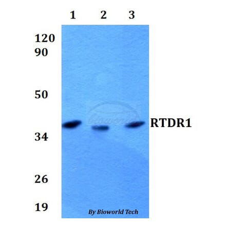 Anti-RTDR1 Antibody from Bioworld Technology (BS60603) - Antibodies.com