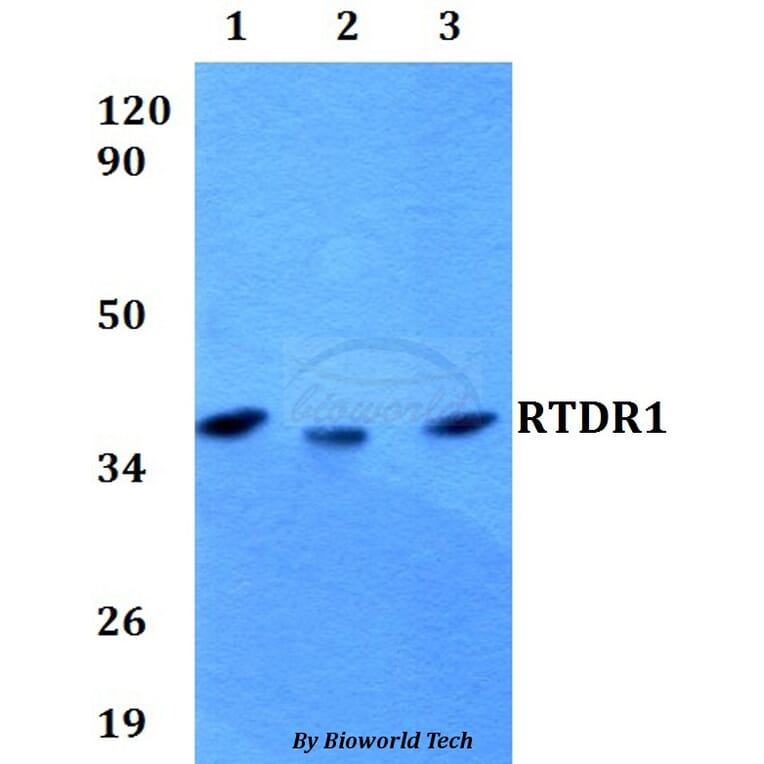 Anti-RTDR1 Antibody from Bioworld Technology (BS60603) - Antibodies.com