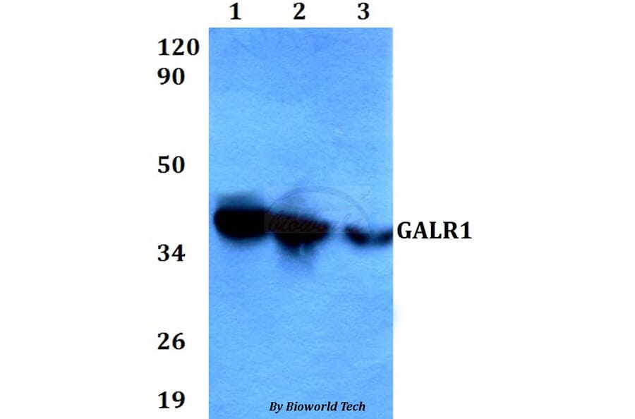 Anti-GALR1 Antibody from Bioworld Technology (BS60604) - Antibodies.com