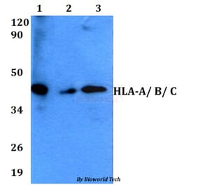 Anti-HLA-A/ B/ C Antibody from Bioworld Technology (BS60609) - Antibodies.com