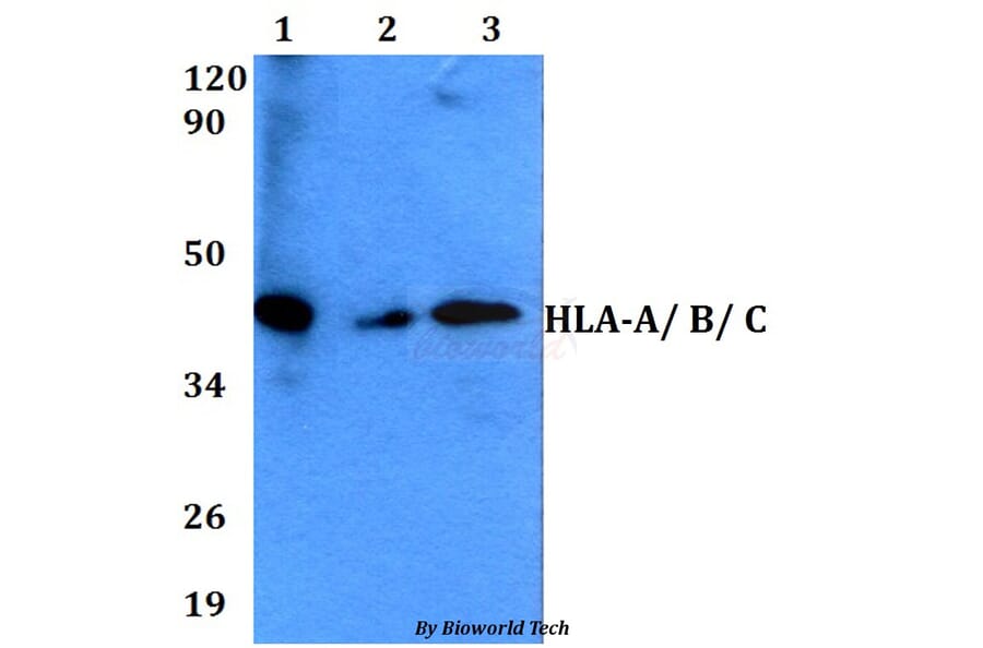 Anti-HLA-A/ B/ C Antibody from Bioworld Technology (BS60609) - Antibodies.com