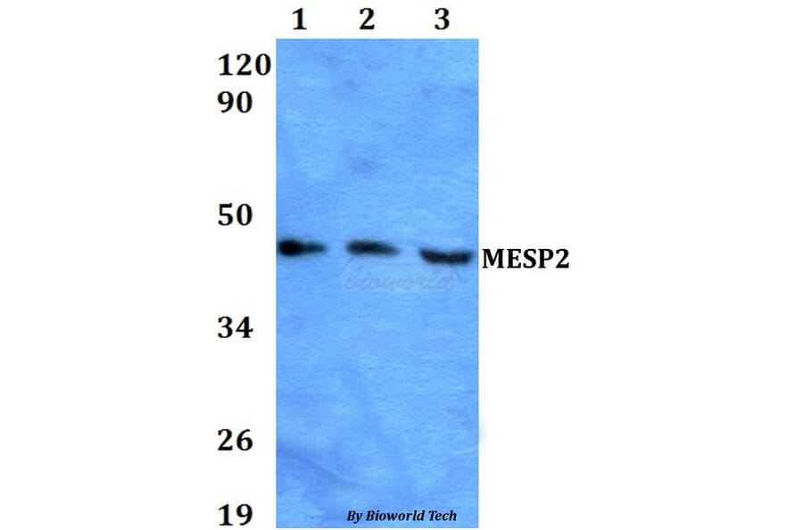 Anti-MESP2 Antibody from Bioworld Technology (BS60610) - Antibodies.com