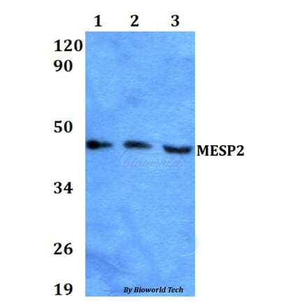 Anti-MESP2 Antibody from Bioworld Technology (BS60610) - Antibodies.com
