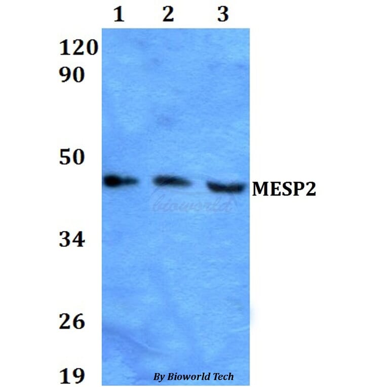 Anti-MESP2 Antibody from Bioworld Technology (BS60610) - Antibodies.com