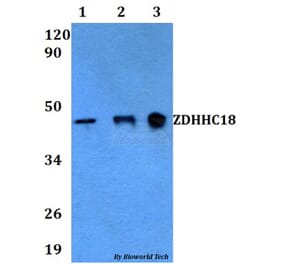 Anti-ZDHHC18 Antibody from Bioworld Technology (BS60611) - Antibodies.com