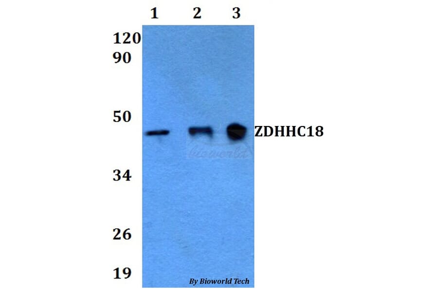 Anti-ZDHHC18 Antibody from Bioworld Technology (BS60611) - Antibodies.com