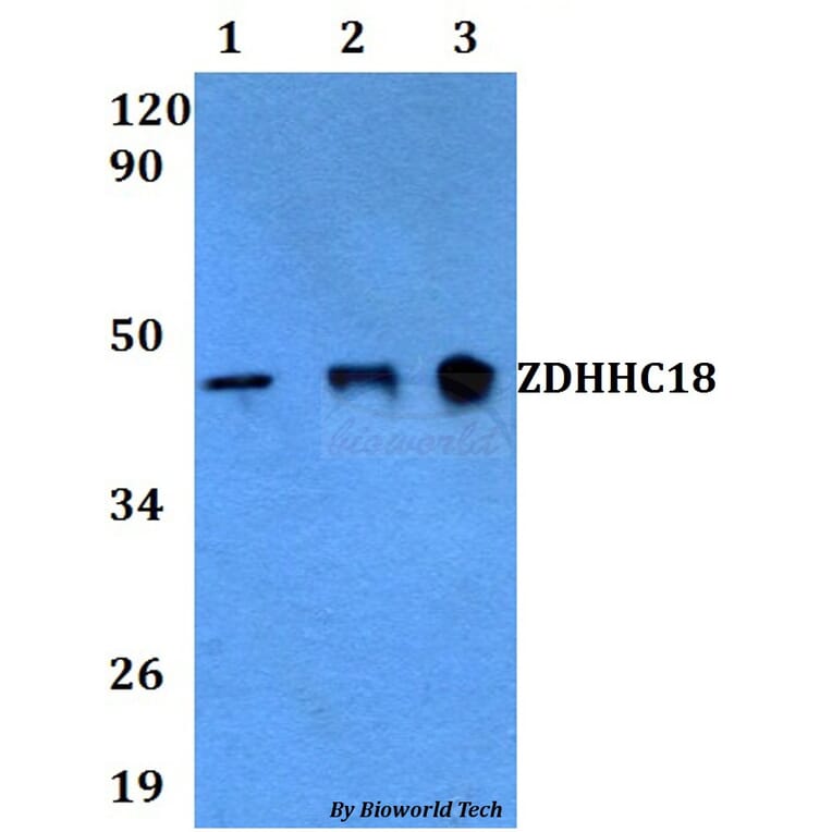 Anti-ZDHHC18 Antibody from Bioworld Technology (BS60611) - Antibodies.com
