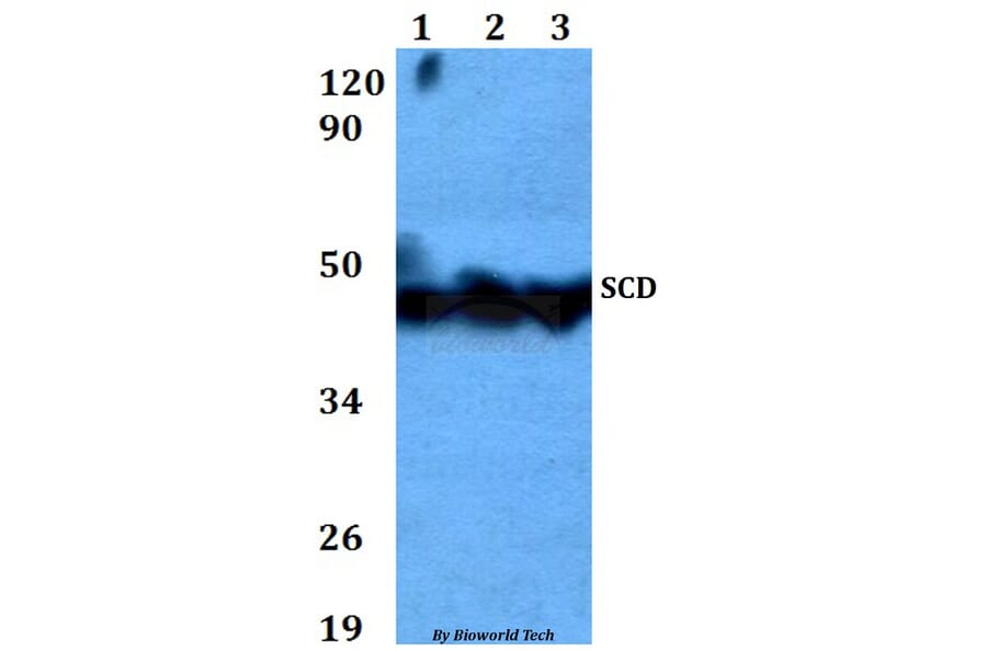 Anti-SCD Antibody from Bioworld Technology (BS60618) - Antibodies.com