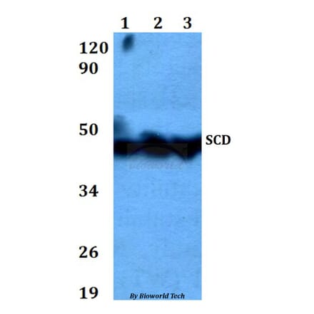 Anti-SCD Antibody from Bioworld Technology (BS60618) - Antibodies.com