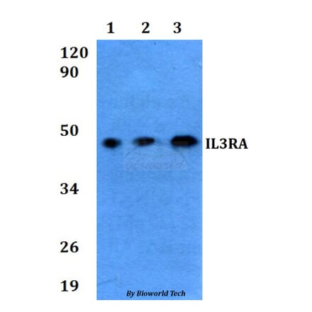 Anti-IL3RA Antibody from Bioworld Technology (BS60620) - Antibodies.com