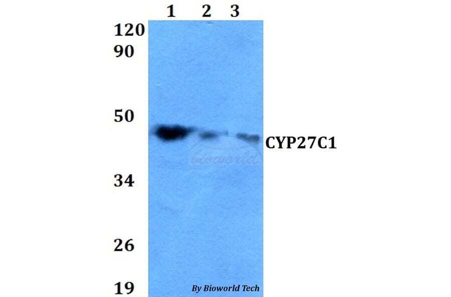 Anti-CYP27C1 Antibody from Bioworld Technology (BS60621) - Antibodies.com