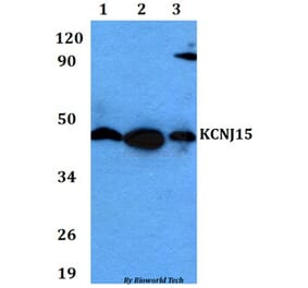 Anti-KCNJ15 Antibody from Bioworld Technology (BS60622) - Antibodies.com