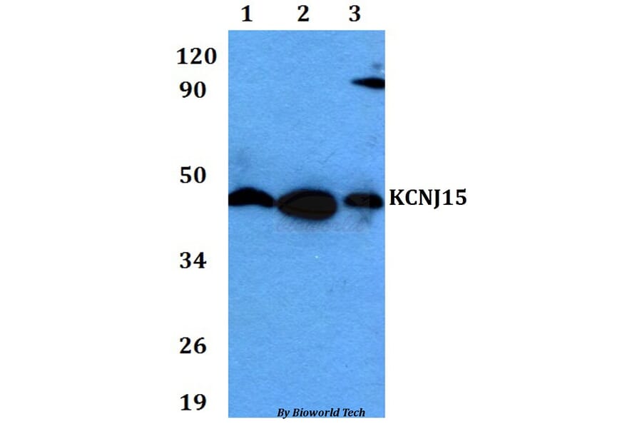 Anti-KCNJ15 Antibody from Bioworld Technology (BS60622) - Antibodies.com