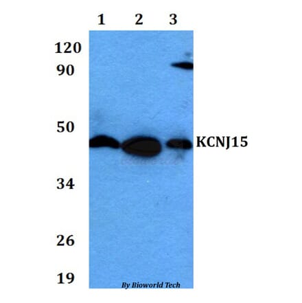 Anti-KCNJ15 Antibody from Bioworld Technology (BS60622) - Antibodies.com