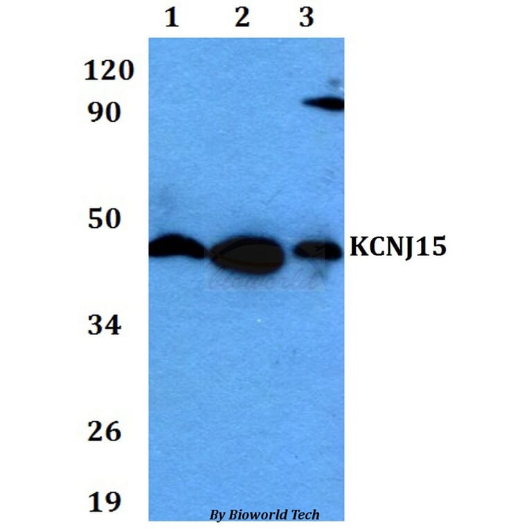 Anti-KCNJ15 Antibody from Bioworld Technology (BS60622) - Antibodies.com