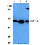 Anti-KCNJ15 Antibody from Bioworld Technology (BS60622) - Antibodies.com