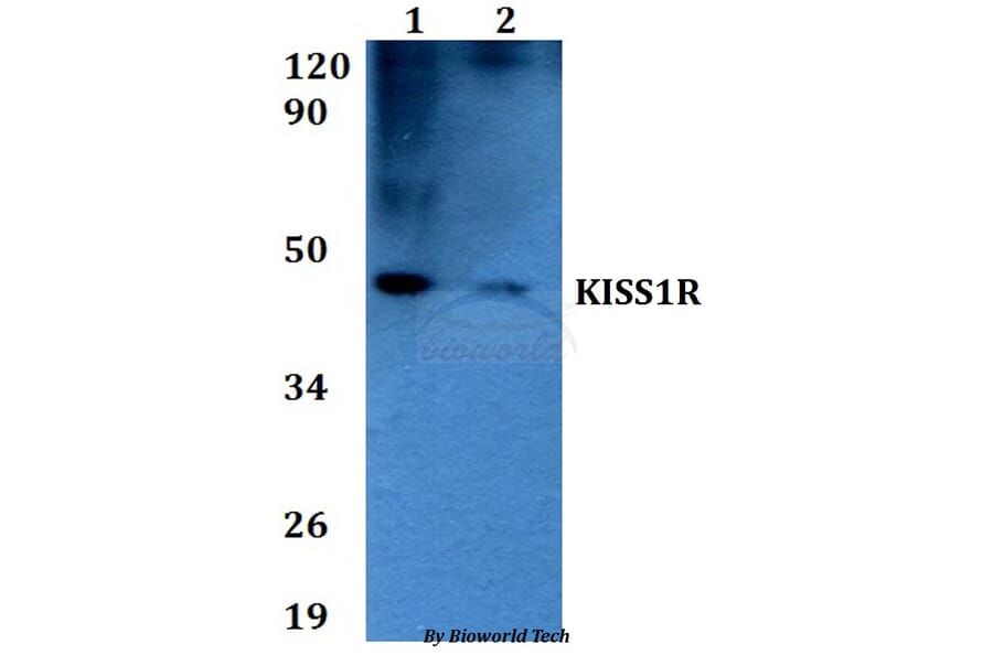 Anti-KISS1R Antibody from Bioworld Technology (BS60624) - Antibodies.com