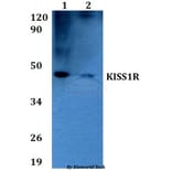 Anti-KISS1R Antibody from Bioworld Technology (BS60624) - Antibodies.com