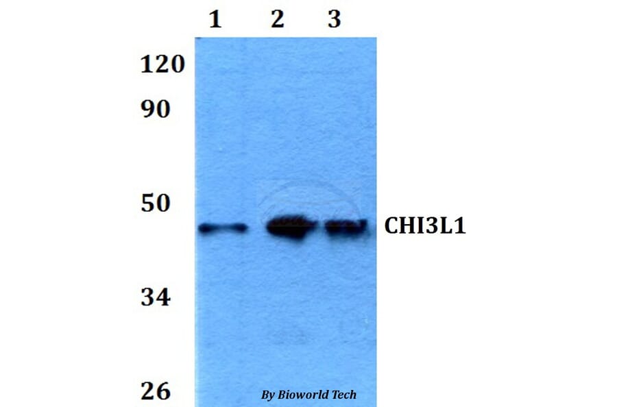 Anti-CHI3L1 Antibody from Bioworld Technology (BS60625) - Antibodies.com