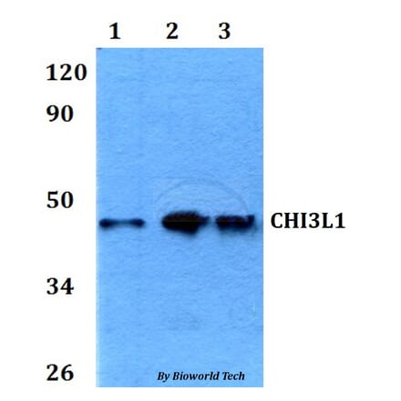 Anti-CHI3L1 Antibody from Bioworld Technology (BS60625) - Antibodies.com