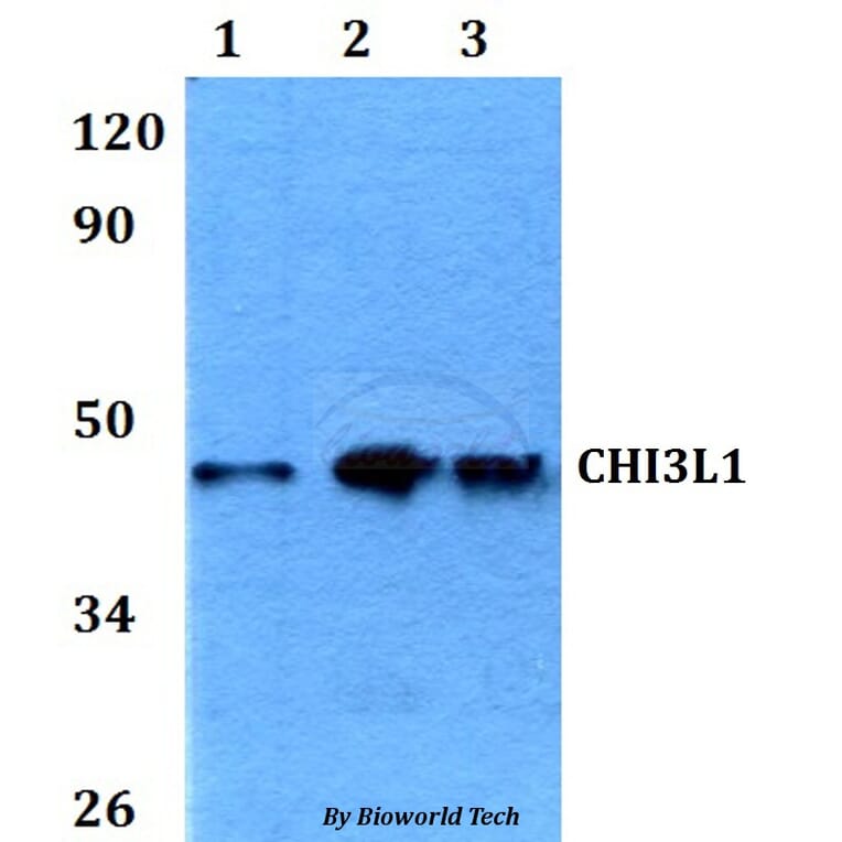 Anti-CHI3L1 Antibody from Bioworld Technology (BS60625) - Antibodies.com