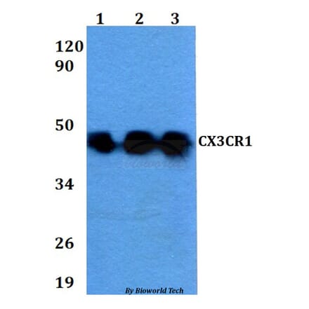 Anti-CX3CR1 Antibody from Bioworld Technology (BS60627) - Antibodies.com