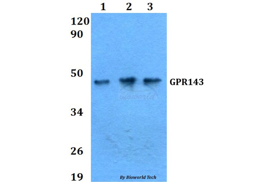 Anti-GPR143 Antibody from Bioworld Technology (BS60628) - Antibodies.com