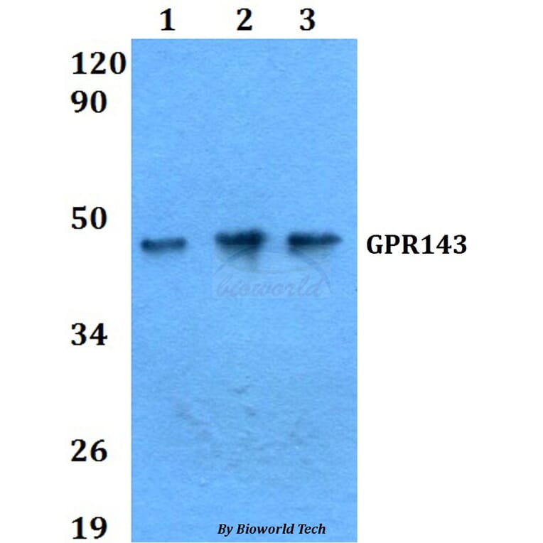 Anti-GPR143 Antibody from Bioworld Technology (BS60628) - Antibodies.com