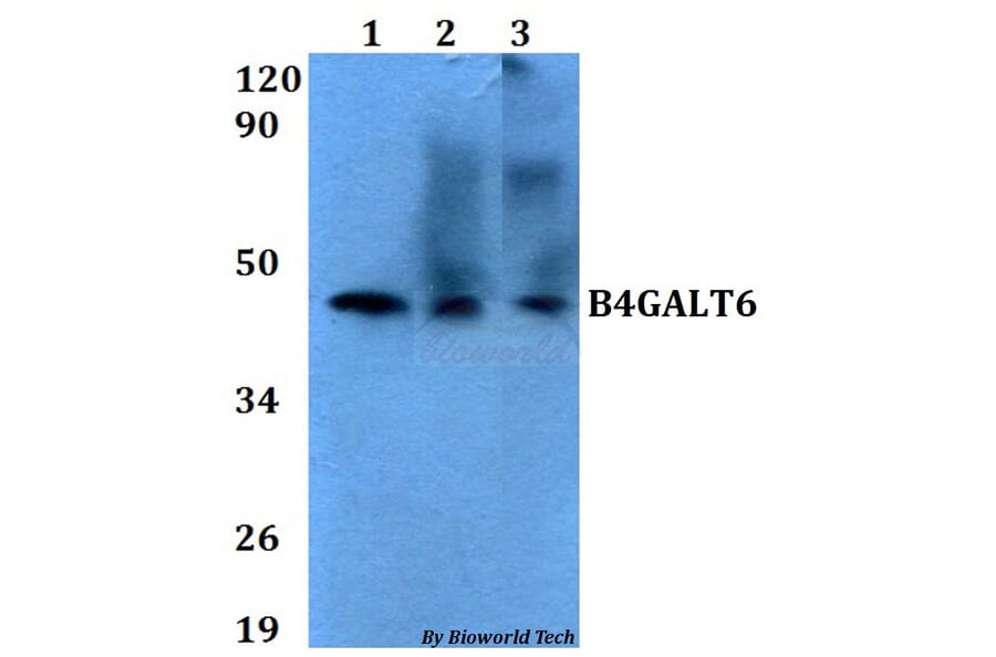 Anti-B4GALT6 Antibody from Bioworld Technology (BS60629) - Antibodies.com