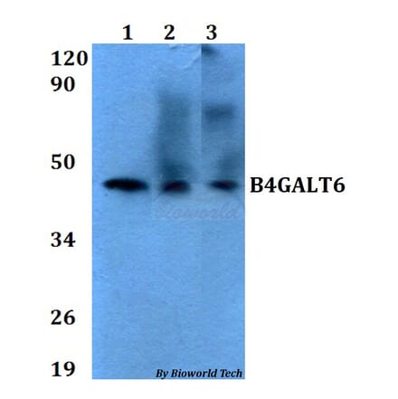 Anti-B4GALT6 Antibody from Bioworld Technology (BS60629) - Antibodies.com