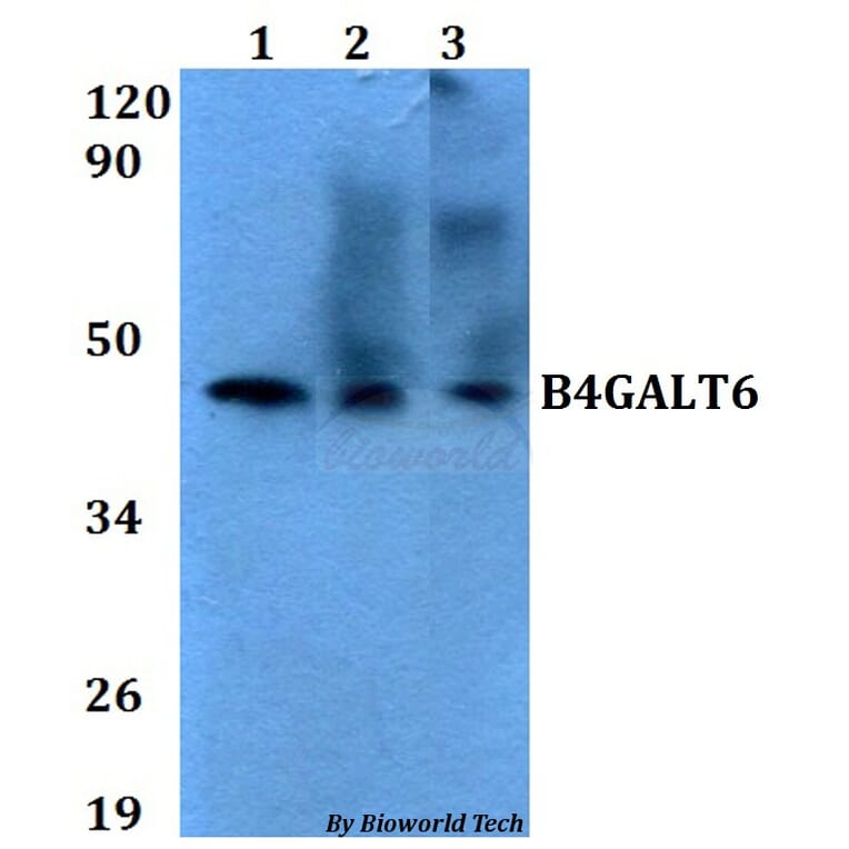 Anti-B4GALT6 Antibody from Bioworld Technology (BS60629) - Antibodies.com