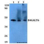 Anti-B4GALT6 Antibody from Bioworld Technology (BS60629) - Antibodies.com