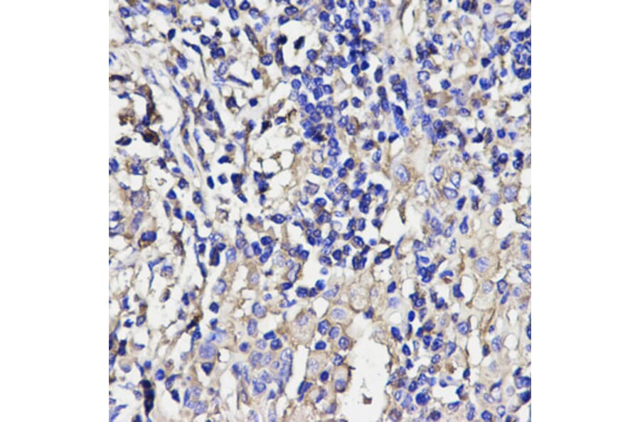 Anti-ANGPT2 Antibody from Bioworld Technology (BS6063) - Antibodies.com