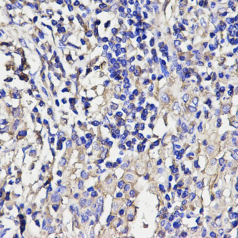 Anti-ANGPT2 Antibody from Bioworld Technology (BS6063) - Antibodies.com